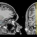 Study Looks Inside the Brain During Sleep to Show How Memory Is Stored