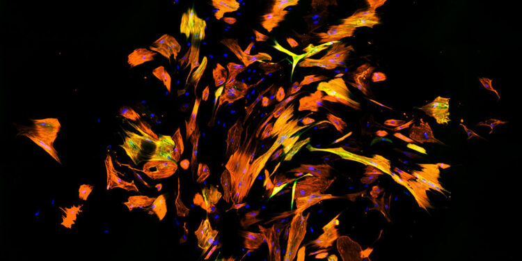 Newly Discovered Protein Partners Could Heal the Heart