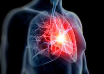 A Bizarre Case of Hypertension Immunity