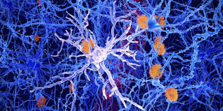 The roles of innate and adaptive immunity in Alzheimer’s disease development and progression