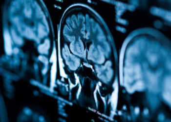 Study sheds light on the neurocognitive processes linked to perceiving social injustice during arrests of Black civilians