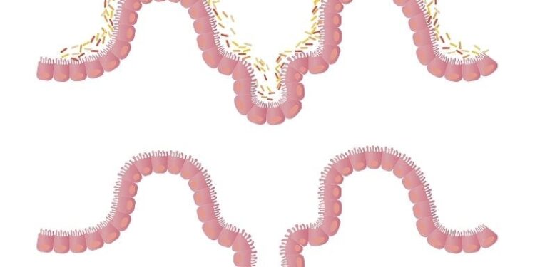 Researchers Pinpoint ‘Depressing’ Gut Microbe With Potential for Psychobiotic Drugs