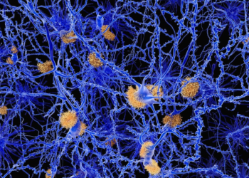 Blood test in study detects toxic proteins fundamental to dementia before symptoms develop