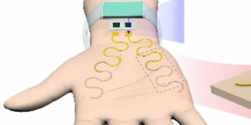 Palm e-Tattoo Can Tell When You’re Stressed Out