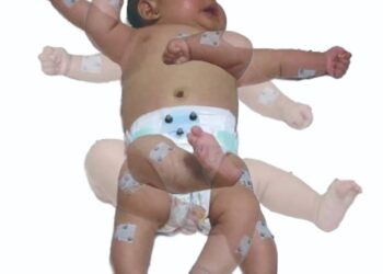 Spontaneous Baby Movements Are Important for Development of Coordinated Sensorimotor System