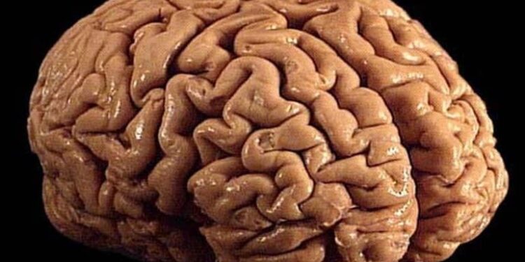 Study Identifies Cause for Excessive Folding of Gyri in Human Cerebral Cortex