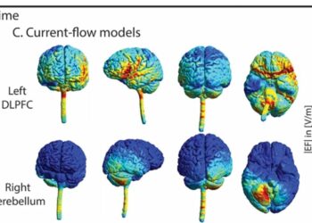 Stimulation of the Cerebellum Improves Episodic Memory in Older People