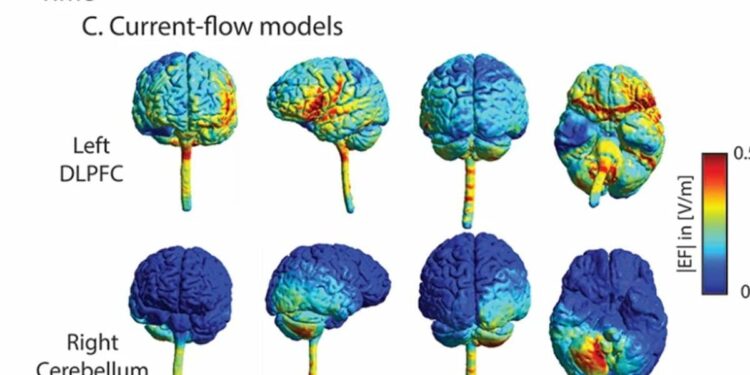 Stimulation of the Cerebellum Improves Episodic Memory in Older People