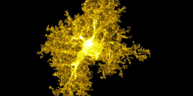 The Brain’s Support Cells May Play a Key Role in OCD