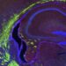 Unique Omega-3 Fatty Acid Lipid Could Revolutionize Our Understanding of Brain Development and Aging