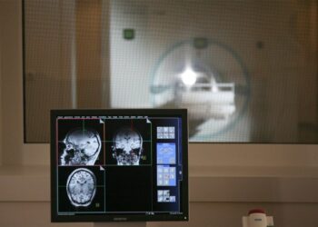 Revolutionary MRI Imaging Technique Reveals Brain Glucose Metabolism Without Radiation Exposure