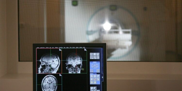 Revolutionary MRI Imaging Technique Reveals Brain Glucose Metabolism Without Radiation Exposure