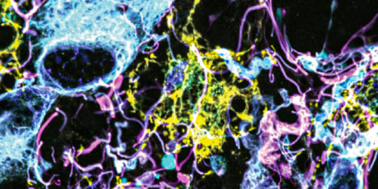 Imaging method reveals new cells and structures in human brain tissue