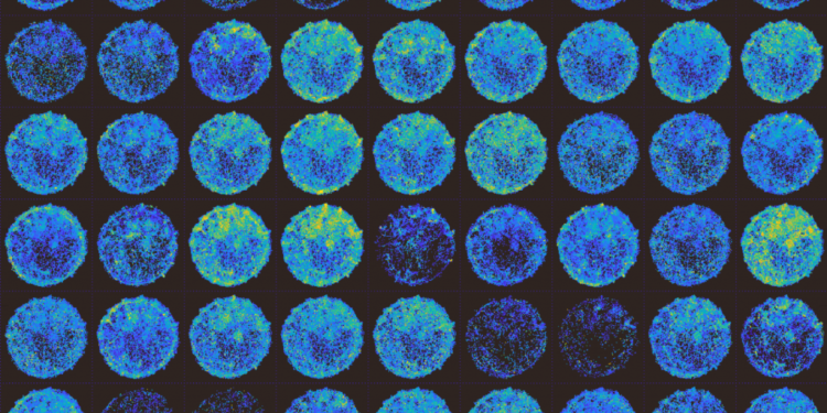 Simons Center’s collaborative approach propels autism research, at MIT and beyond