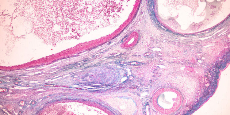 What Do Ovarian Reserve Test Results Mean? (And Can I Improve Them?)