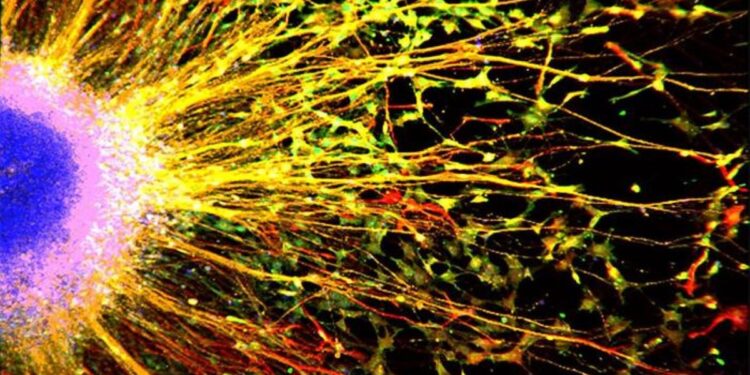 Cancer Drug Shows Promise for Autism Cognitive Function