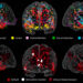 Neuroscientists identify brain network critical for creative idea generation