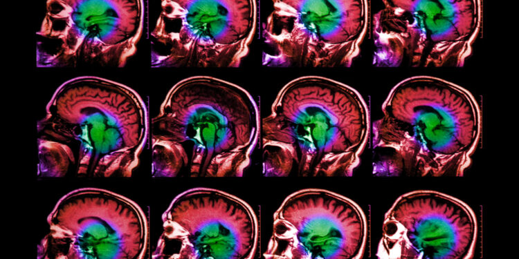 Scientists find neurons that process language on different timescales