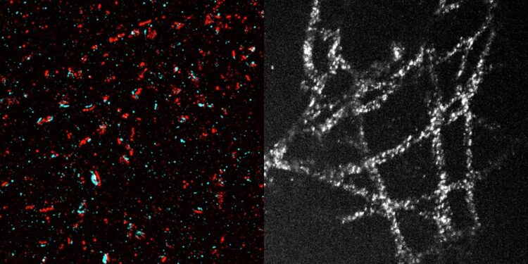 A new method makes high-resolution imaging more accessible