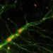 Reprogrammed Brain Cells Could Restore Damaged Circuits