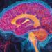 Ketamine Offers Hope for Parkinson’s Treatment-Linked Dyskinesia