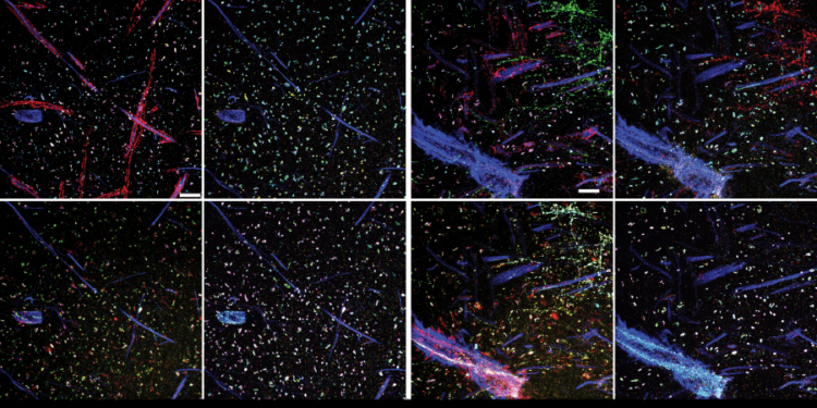 Seeing more in expansion microscopy