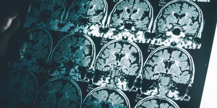 Brain structure and connectivity linked to financial ability in middle-aged and older adults