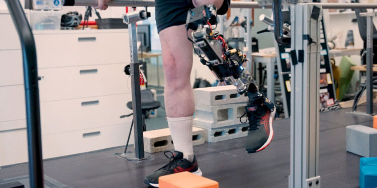 A bionic knee integrated into tissue can restore natural movement