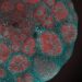 Viagra Ingredient Shows Promise for Rare Childhood Brain Disease in Surprising Study