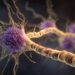 Mono Linked to a Threefold Increase in MS Risk