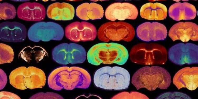 Glucose Levels Signal the Growth of Myelin